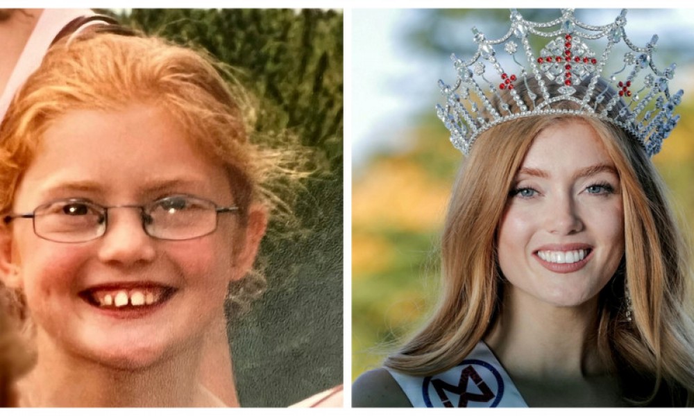 O tânără umilită de colegii de școală a fost încoronată Miss Anglia 2022: „Obișnuiau să mă scuipe și să râdă de culoarea părului meu”